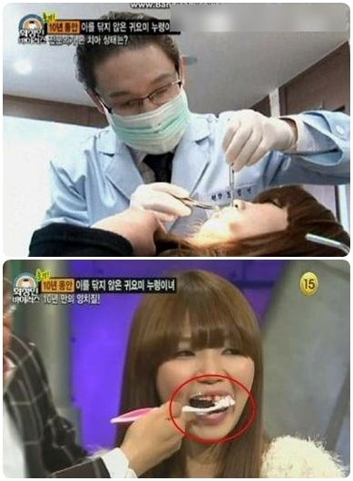 　因为太久未刷牙牙齿竟然开始流血了。医生帮她检查牙齿，说他牙医生涯头一次看到状况这么不好的牙齿。蛀牙十多颗，七颗已经坏掉，牙齿是40~50岁的状态
