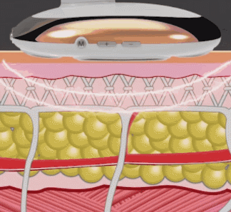 小米再出爆款！众筹24小时破100万，米粉：499元性能不输2999松下