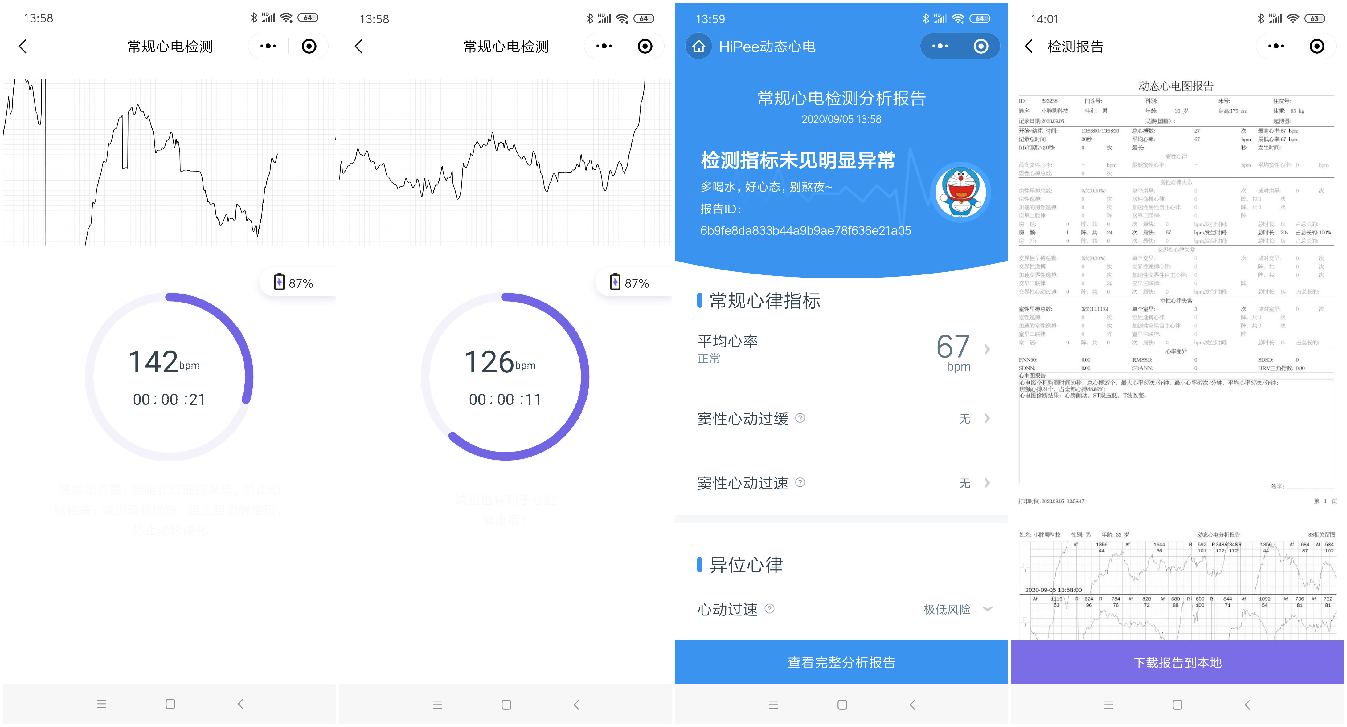 小米有品众筹续命神器，可24小时实时监测心脏，仅499元