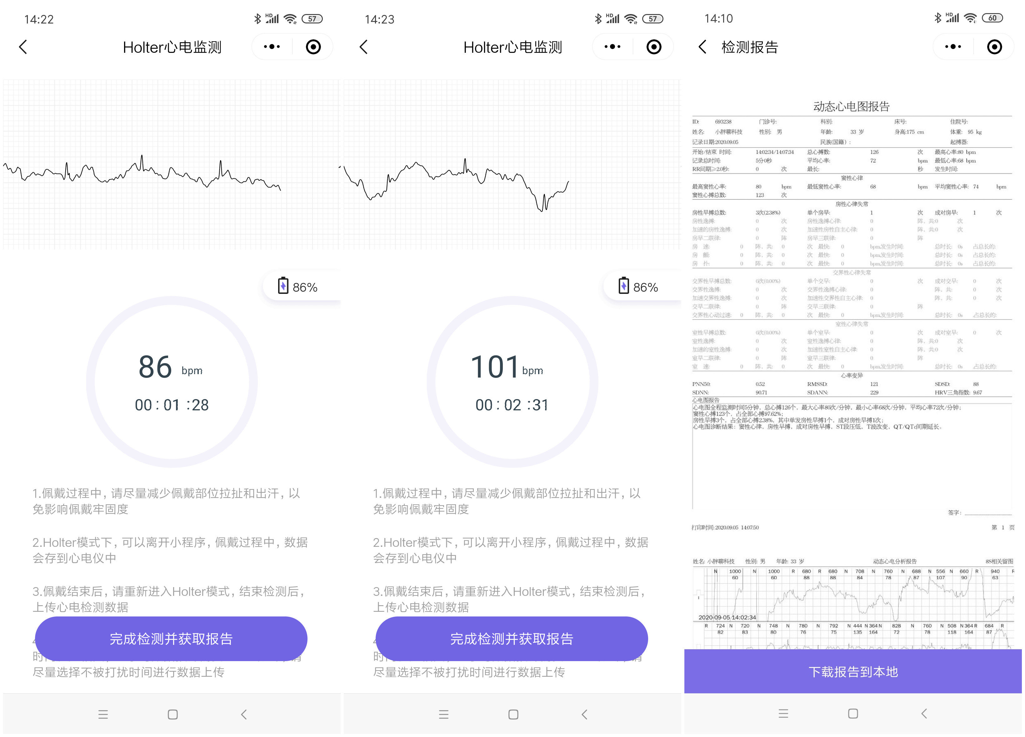 小米有品众筹续命神器，可24小时实时监测心脏，仅499元